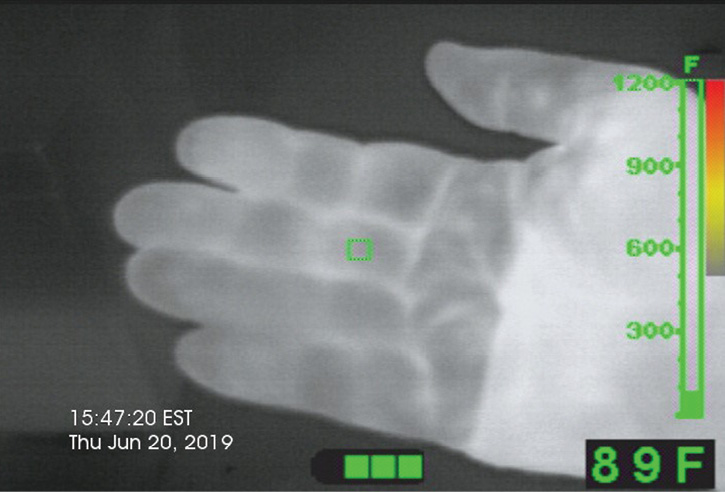 Thermal Imaging